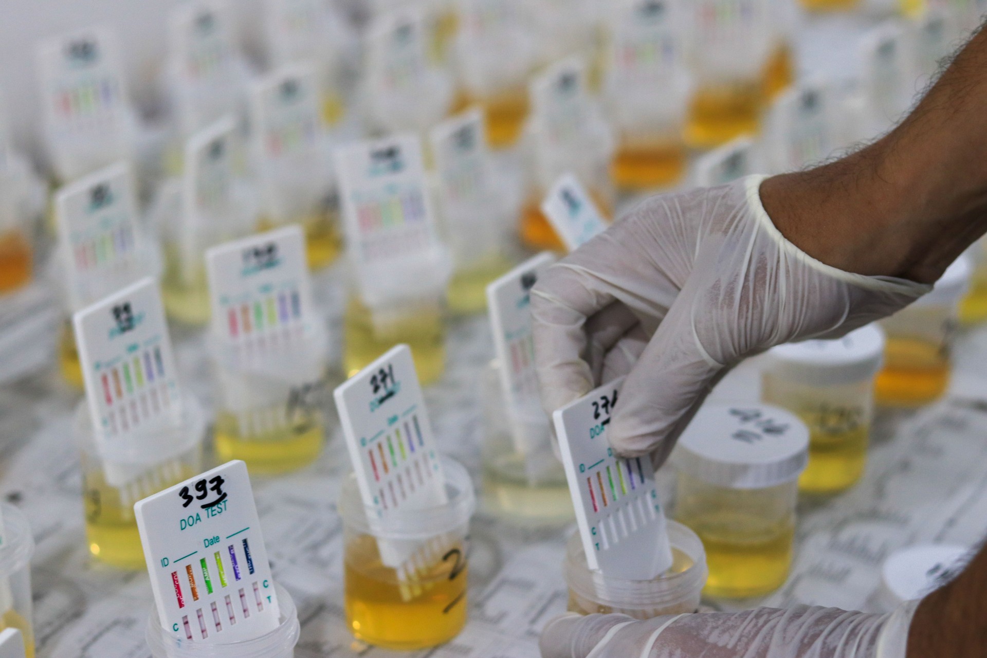Urine Test Kit: Rapid Detection for Drug Abuse